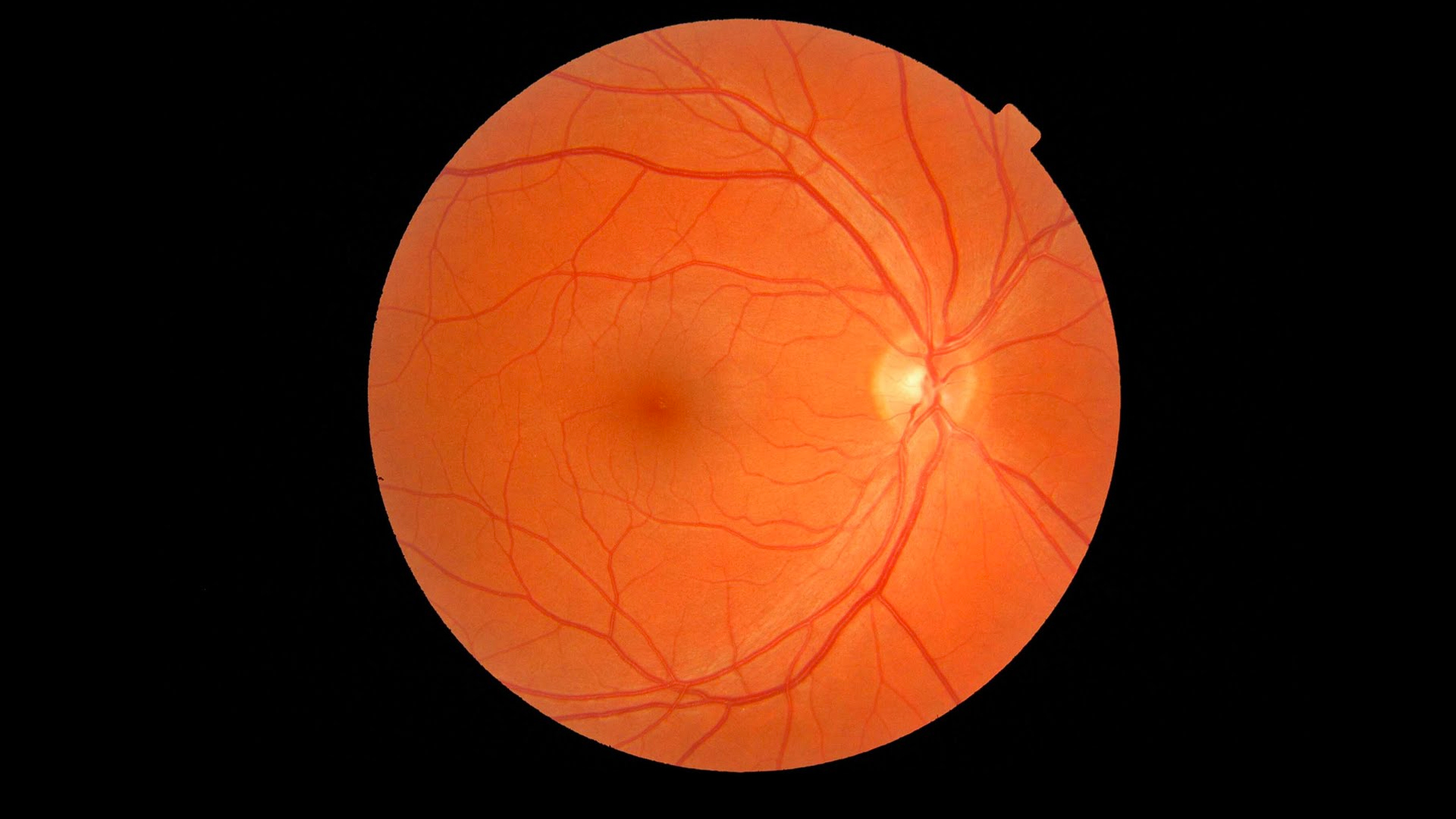 Retina: Anatomy, Function, and Treatment