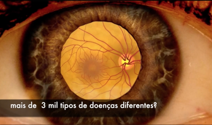 Exame dos olhos tem que ser bem feito e o Oftalmologista sabe fazer.