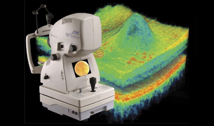 O que é Tomografia de Coerência Óptica- OCT? Para que serve?